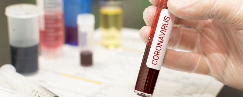 sang dans un tube coronavirus