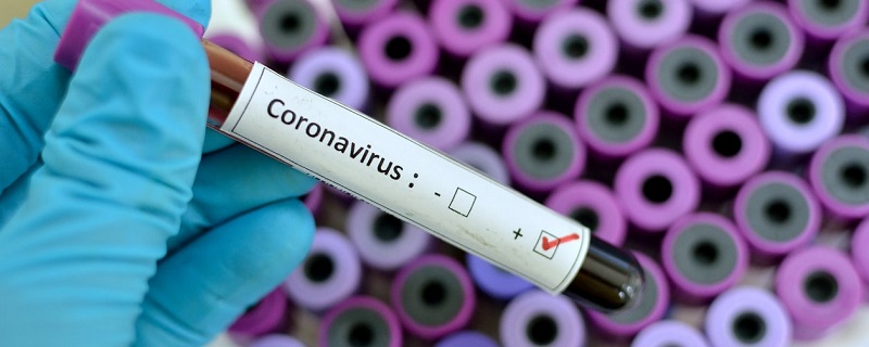 test cornavirus