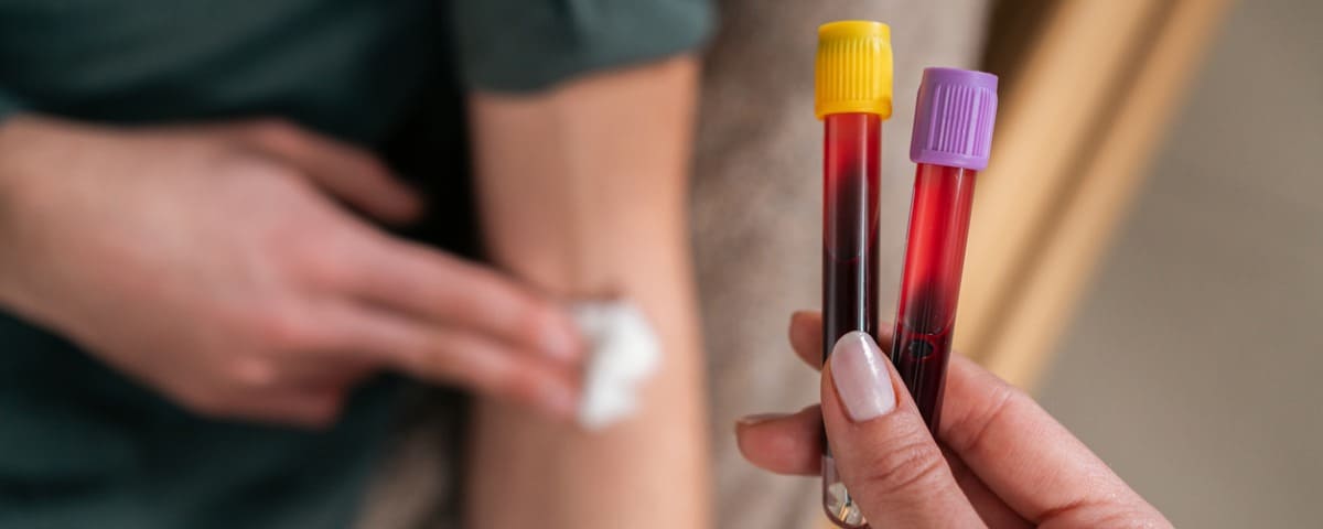 Un nouveau test sanguin pour révolutionner le diagnostic du trouble bipolaire en France