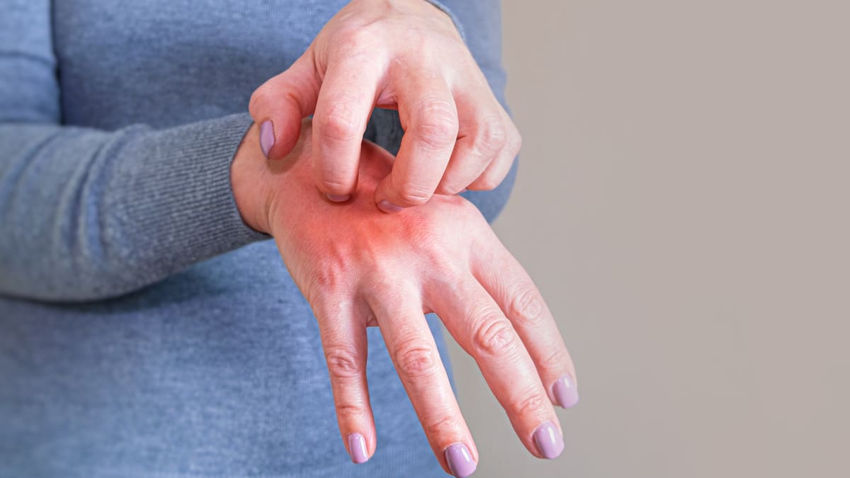 La gale n’a pas encore été éradiquée en France