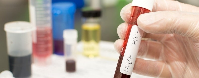 examens du Sida pour assurance prêt immobilier