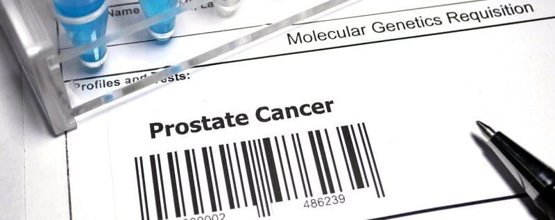 Examens du cancer de la prostate